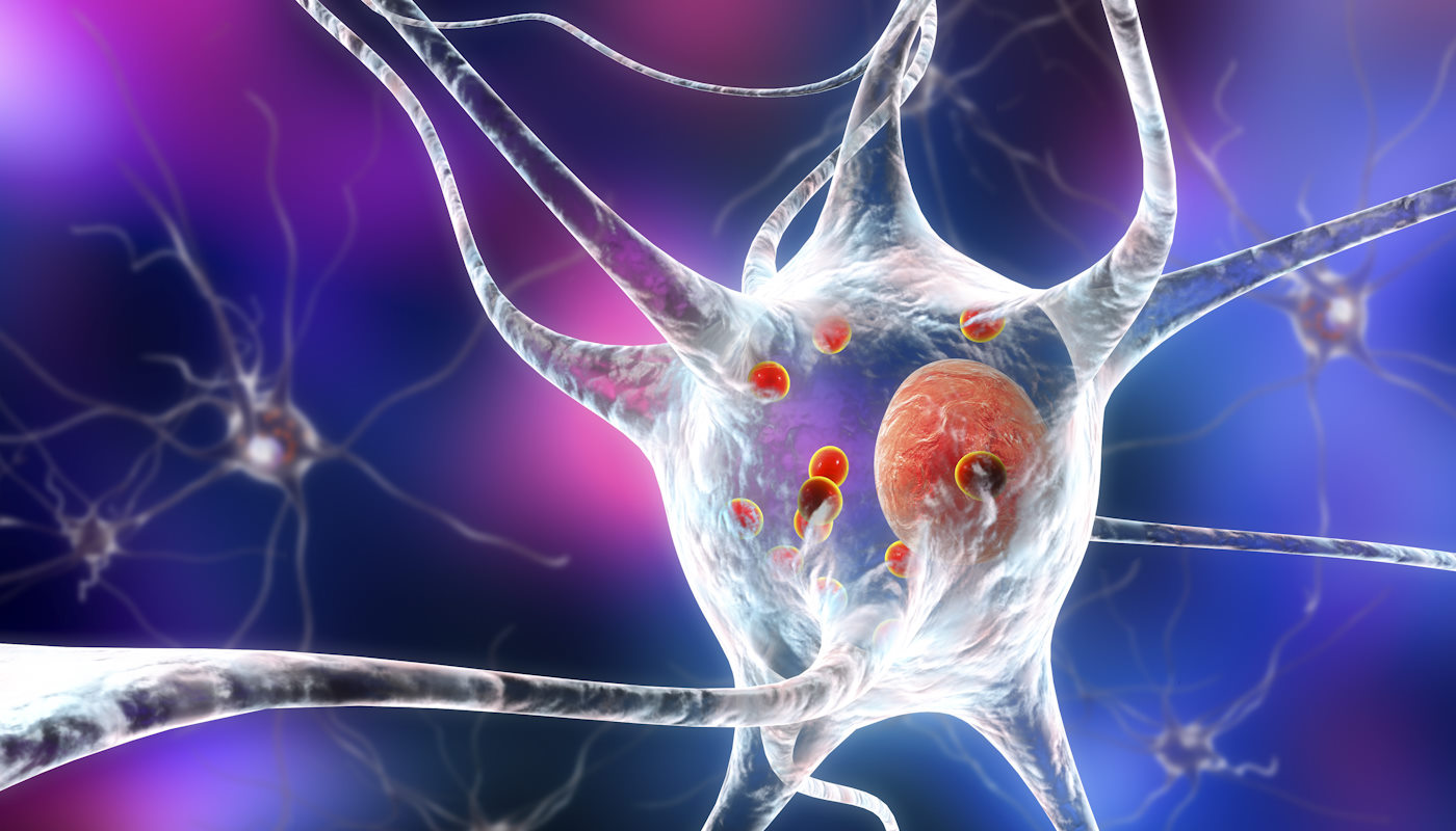 Odwrócenie Parkinsona możliwe? Naukowcy dokonali przełomu