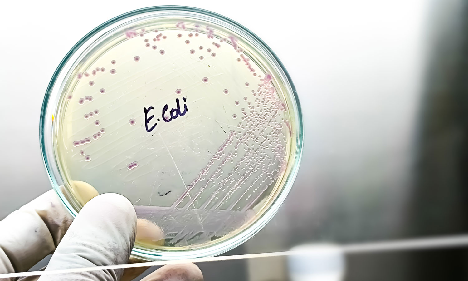 Ta choroba rozprzestrzenia się tak szybko, jak świńska grypa