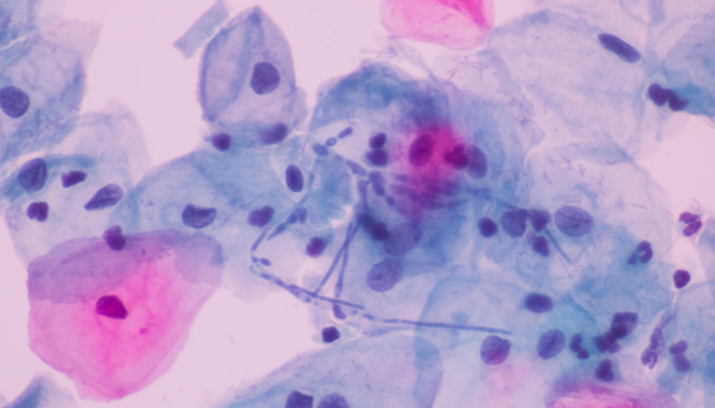 Czy życie na Marsie jest możliwe? Najnowszy eksperyment wiele ujawnił