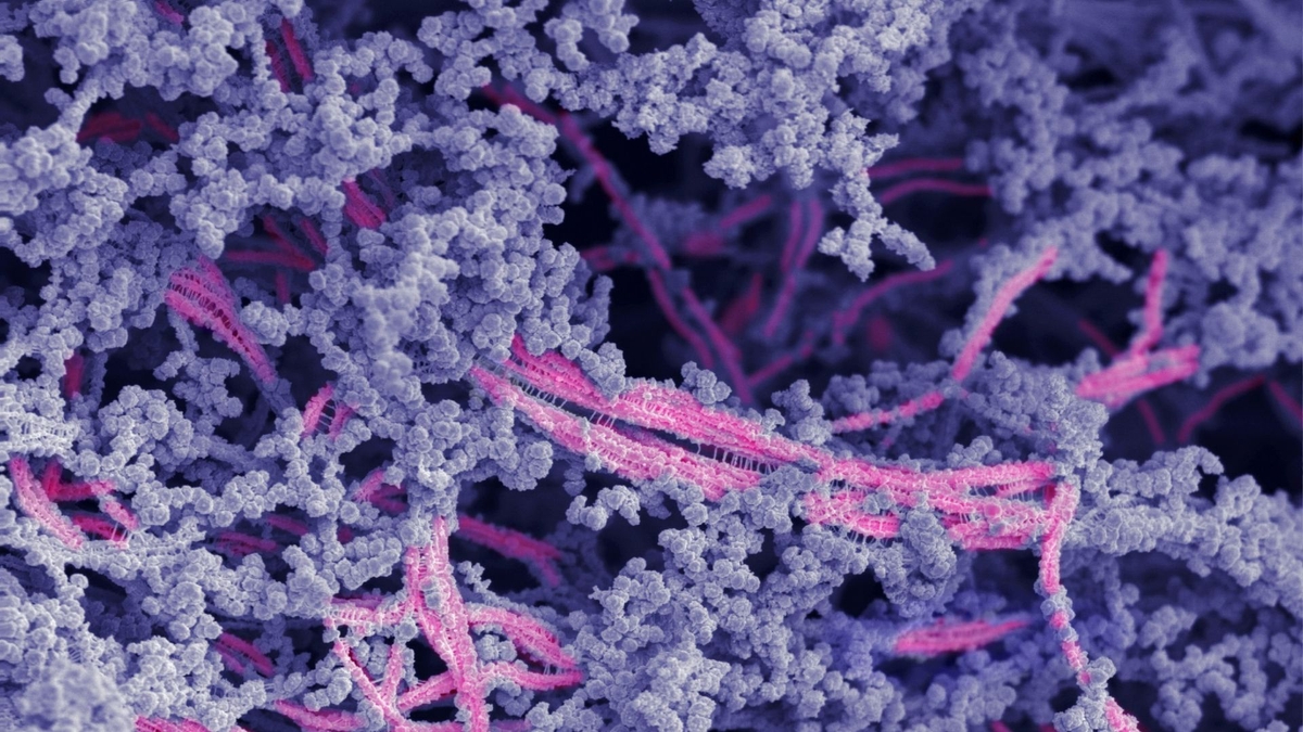 Biomateriał zamiast operacji. Kolana będą jak nowe