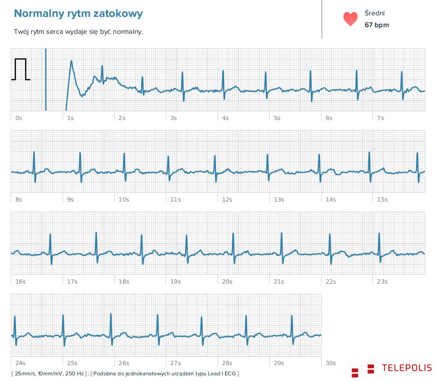 Fitbit Sense – smart zegarek z EKG. Zadbasz z nim o zdrowie i aktywność sportową